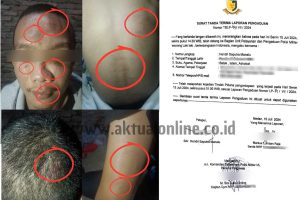 Diduga Tak Terima Adiknya Dipacari, Oknum Tentara Gebuk Pemuda di Medan Johor Nyaris Kritis