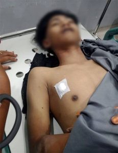 Bentrok Antar Lorong di Belawan Telan Korban Jiwa, Seorang Remaja Tewas Ditembus Senapan Angin